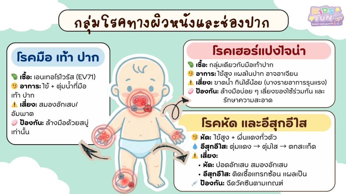 โรคที่พบบ่อยในเด็ก กลุ่มโรคทางผิวหนังและช่องปาก: โรคยอดฮิตในสถานศึกษา